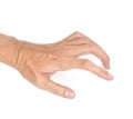 DupuytrenÃ¢â¬â¢s contracture in left hand of Asian young man.